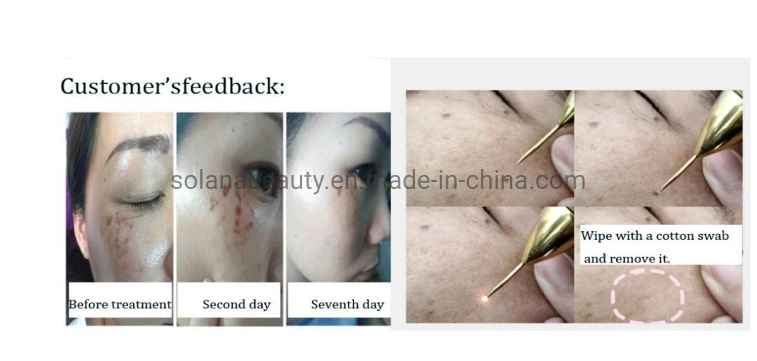 Professional Medical Plasma Pen for Eye Lift Scar Acne Removal Skin Tightening