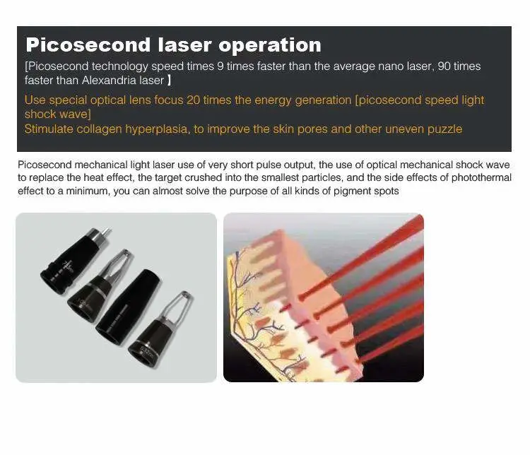 Picosecond Laser Q Switched ND YAG Laser Tattoo Removal Speckle Removal Pico Laser Tattoo Removal Eyebrow Line Beauty Device