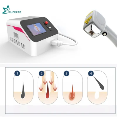 Macchina laser portatile a picosecondi per la rimozione dei tatuaggi, dispositivo peeling laser a carbonio commutato